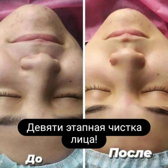 Услуги косметолога эстета. Девяти этапная чистка лица всего