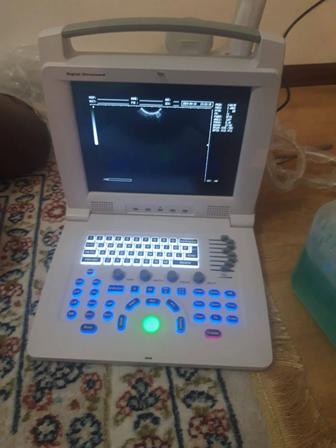 Digital ultrasound портативный узи аппарат