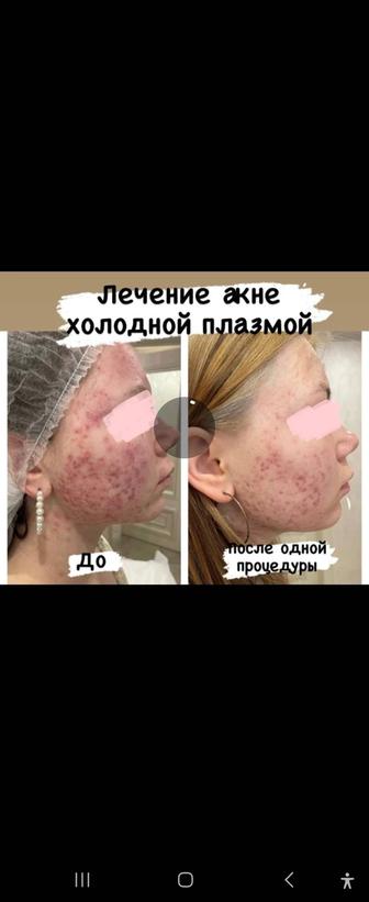 Холодная плазма