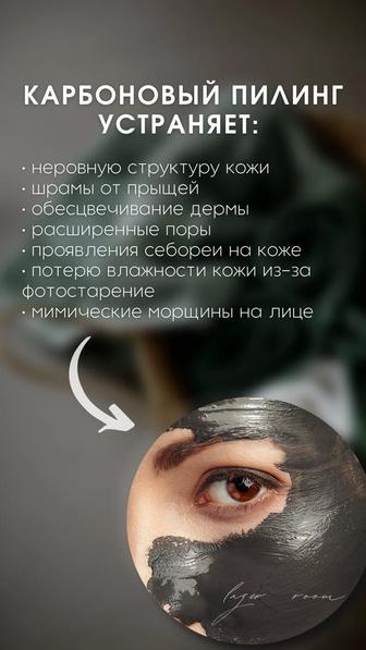 Карбоновый пилинг