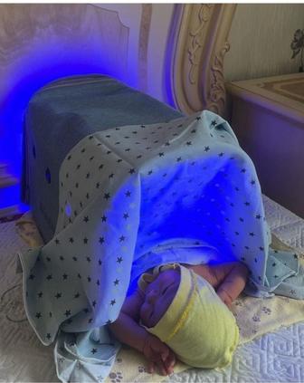 Лампа для лечения желтухи у новорожденных (фототерапия)