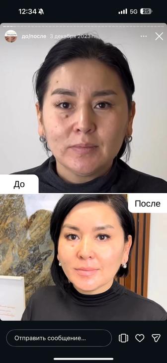 Осветление лица