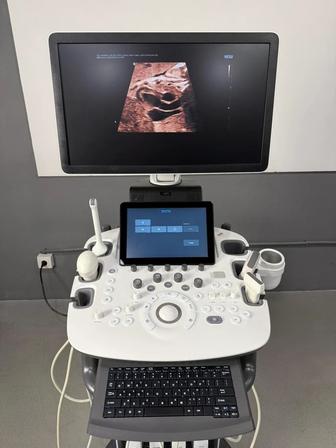 Продам узи Самсунг HS60