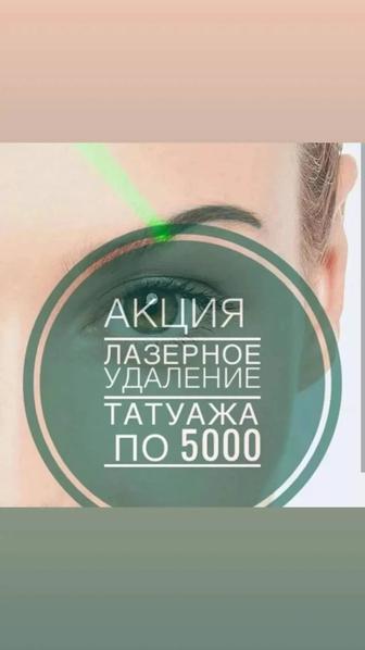 Удаление татуажа лазером