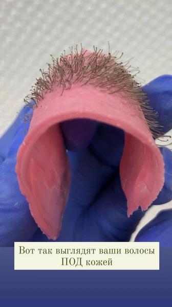 Депиляция/Шугаринг/полимер/Воск. Стаж 8 лет