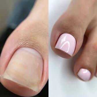 Педикюр, эстетический