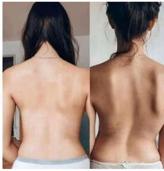 Лечебный биоэнергомассаж Fohow