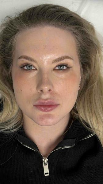 Увеличение губ в Алматы Натуральный результат