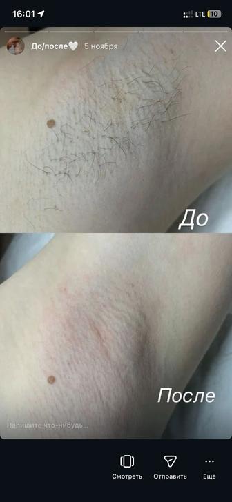 Услуги мастера депиляции